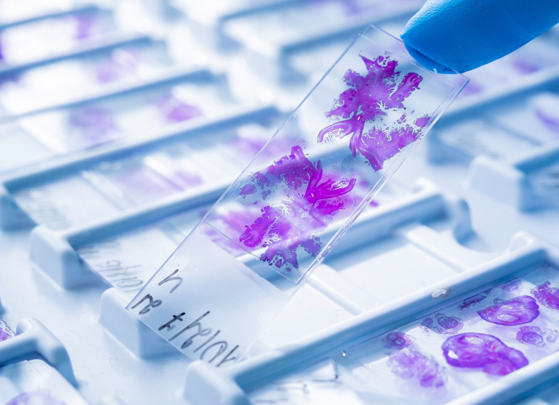 Supporting next stage growth with a new digital presence for a leader in therapeutic cancer treatment