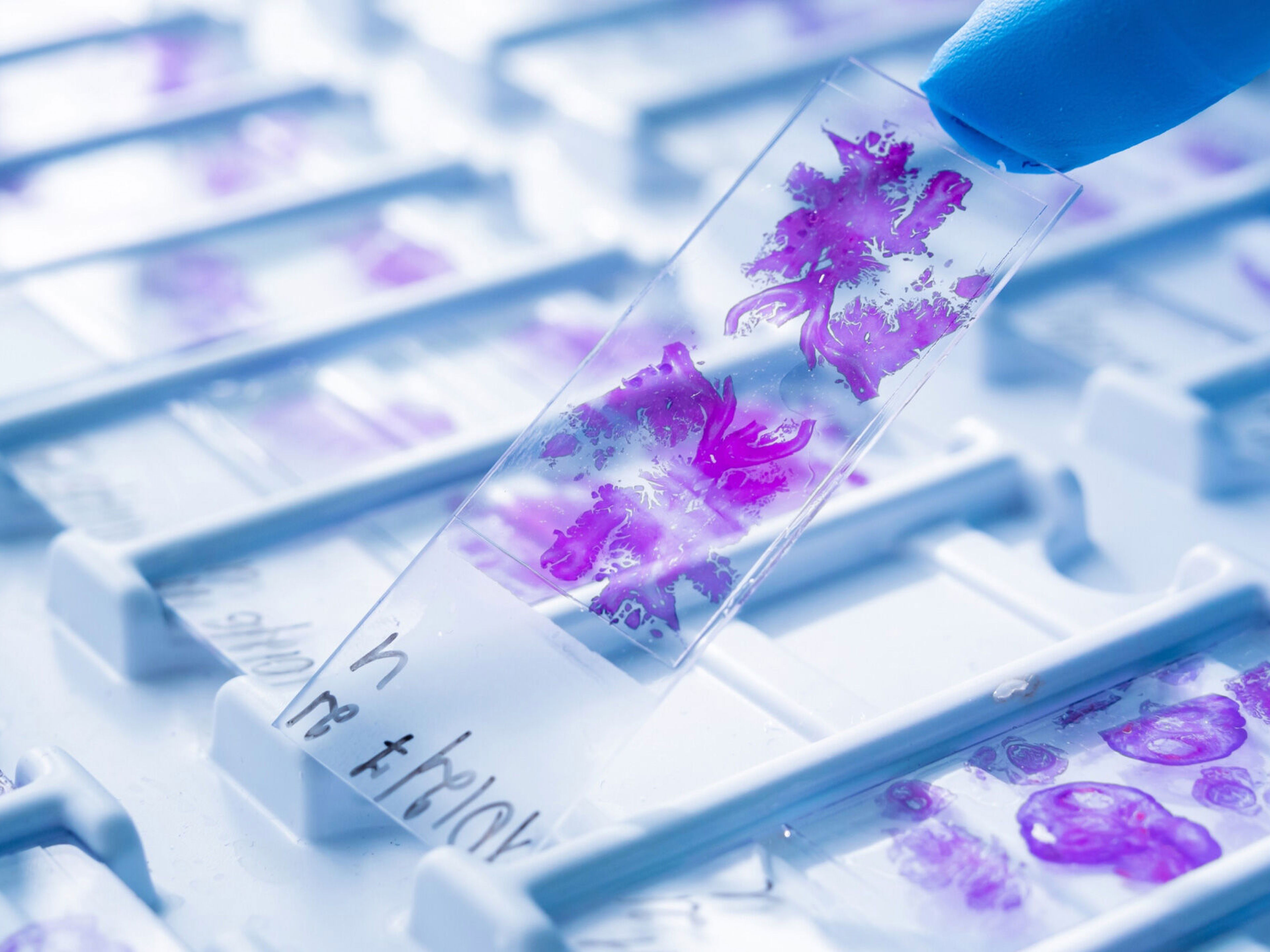 Supporting next stage growth with a new digital presence for a leader in therapeutic cancer treatment