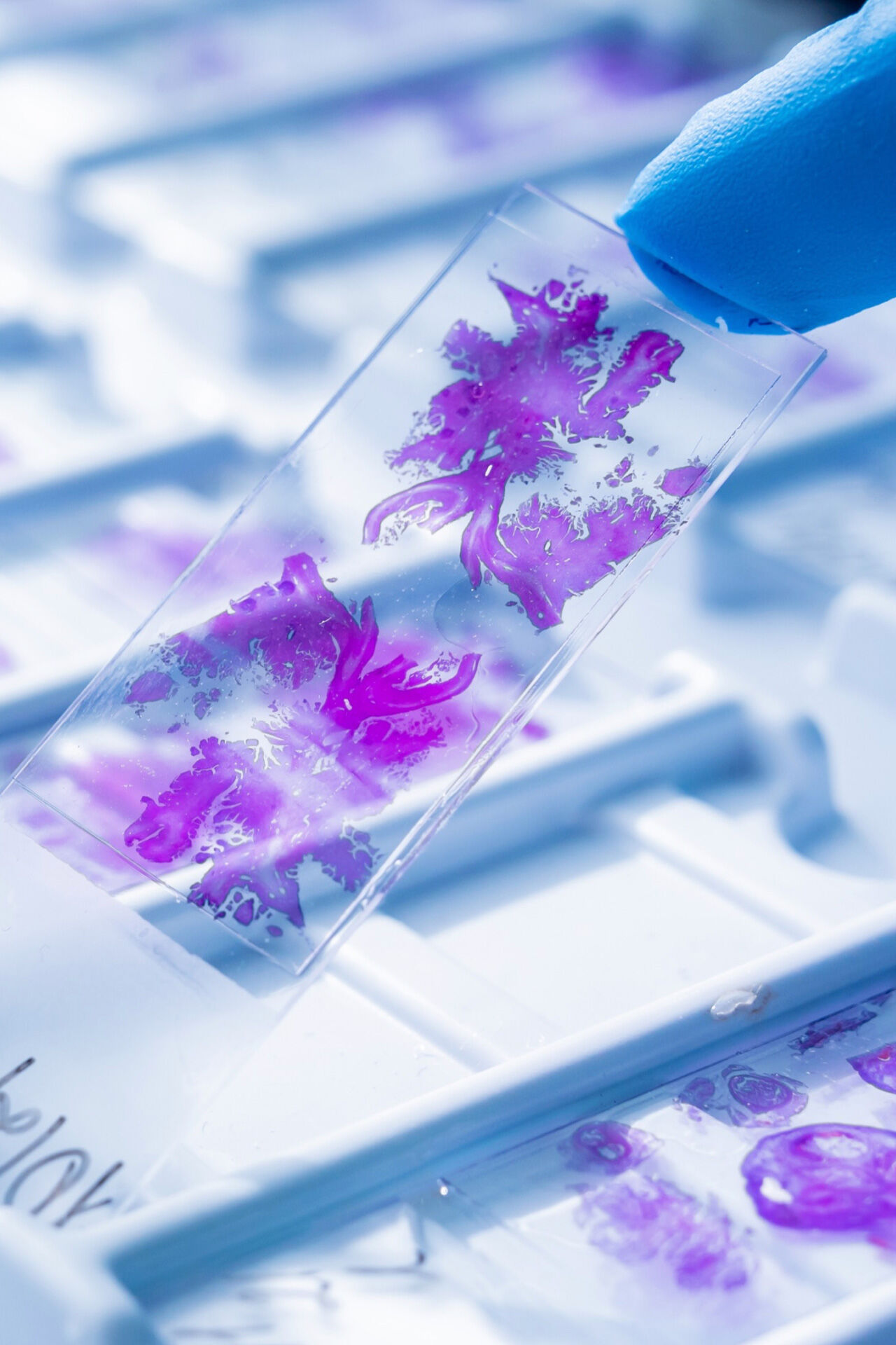 Supporting next stage growth with a new digital presence for a leader in therapeutic cancer treatment