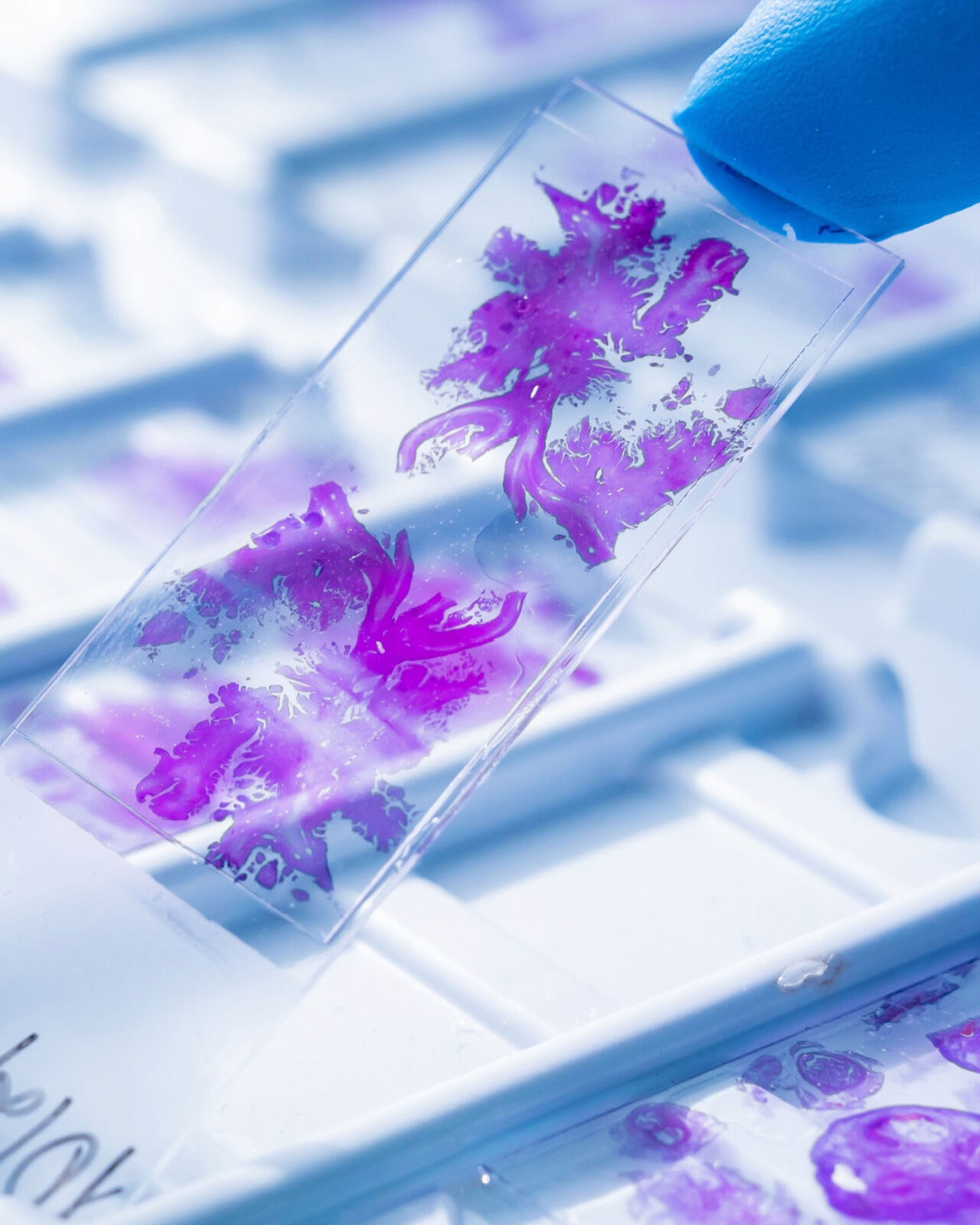 Supporting next stage growth with a new digital presence for a leader in therapeutic cancer treatment